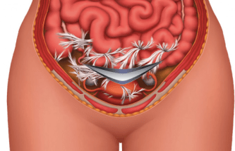 Screen Shot 2018-08-14 at 2.30.39 PM